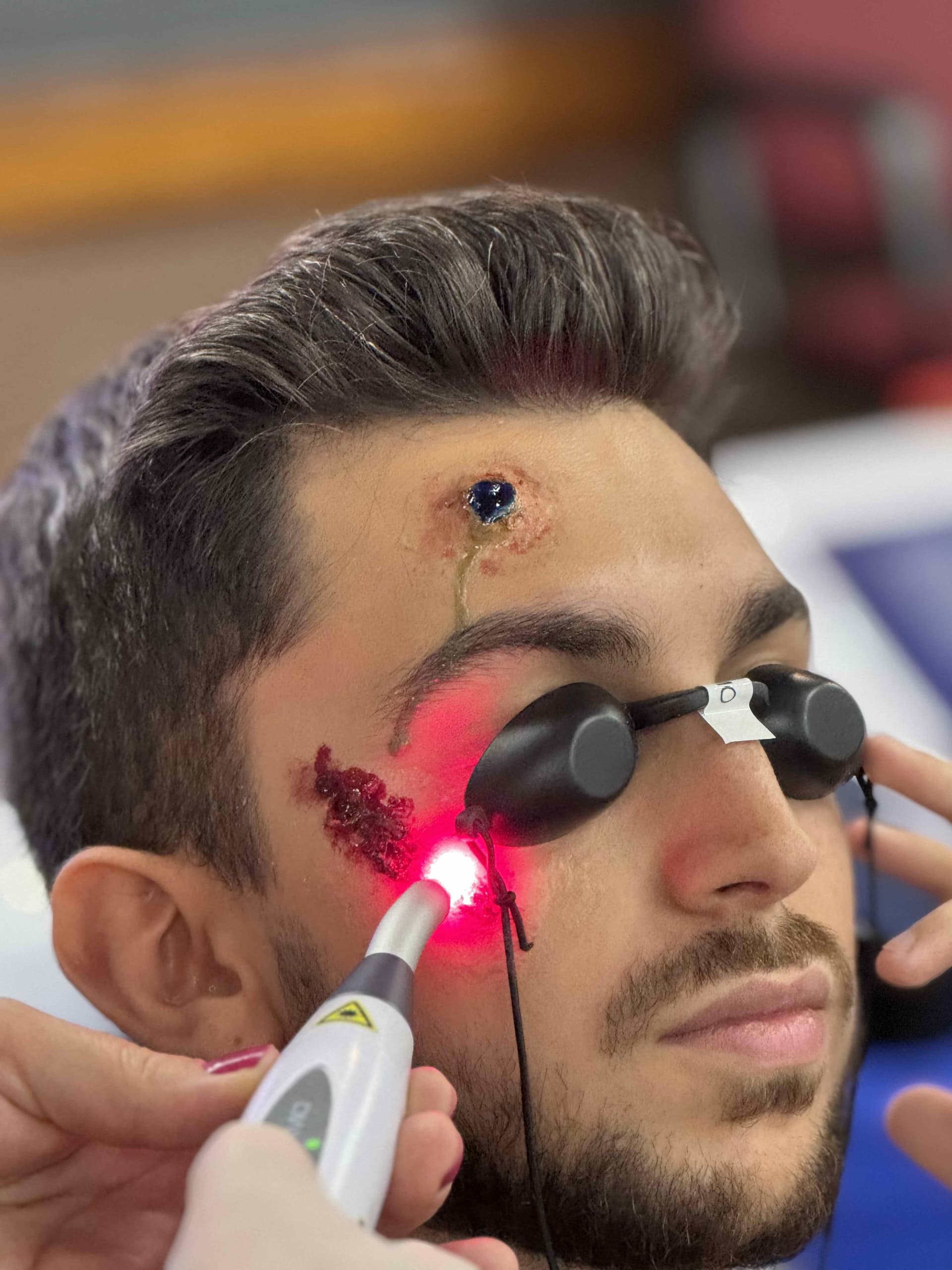 Fotobiomodulação Transcraniana